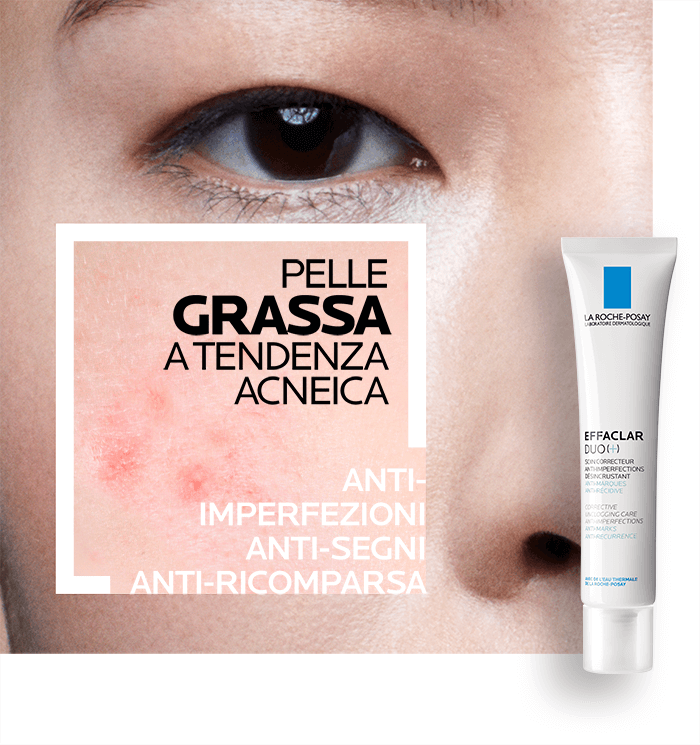 La Roche Posay pelle grassa
